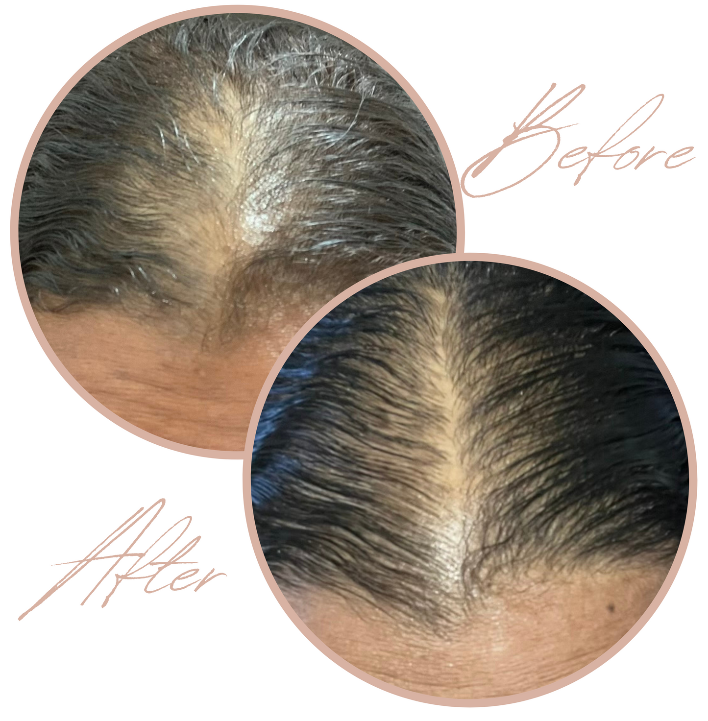 1 Hair Growth Serum