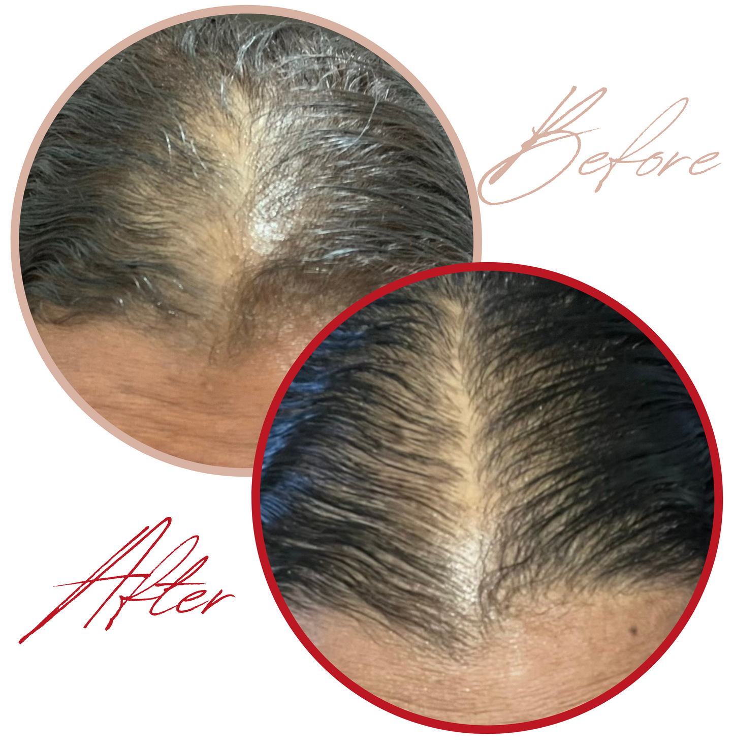 2 Hair Growth Serums