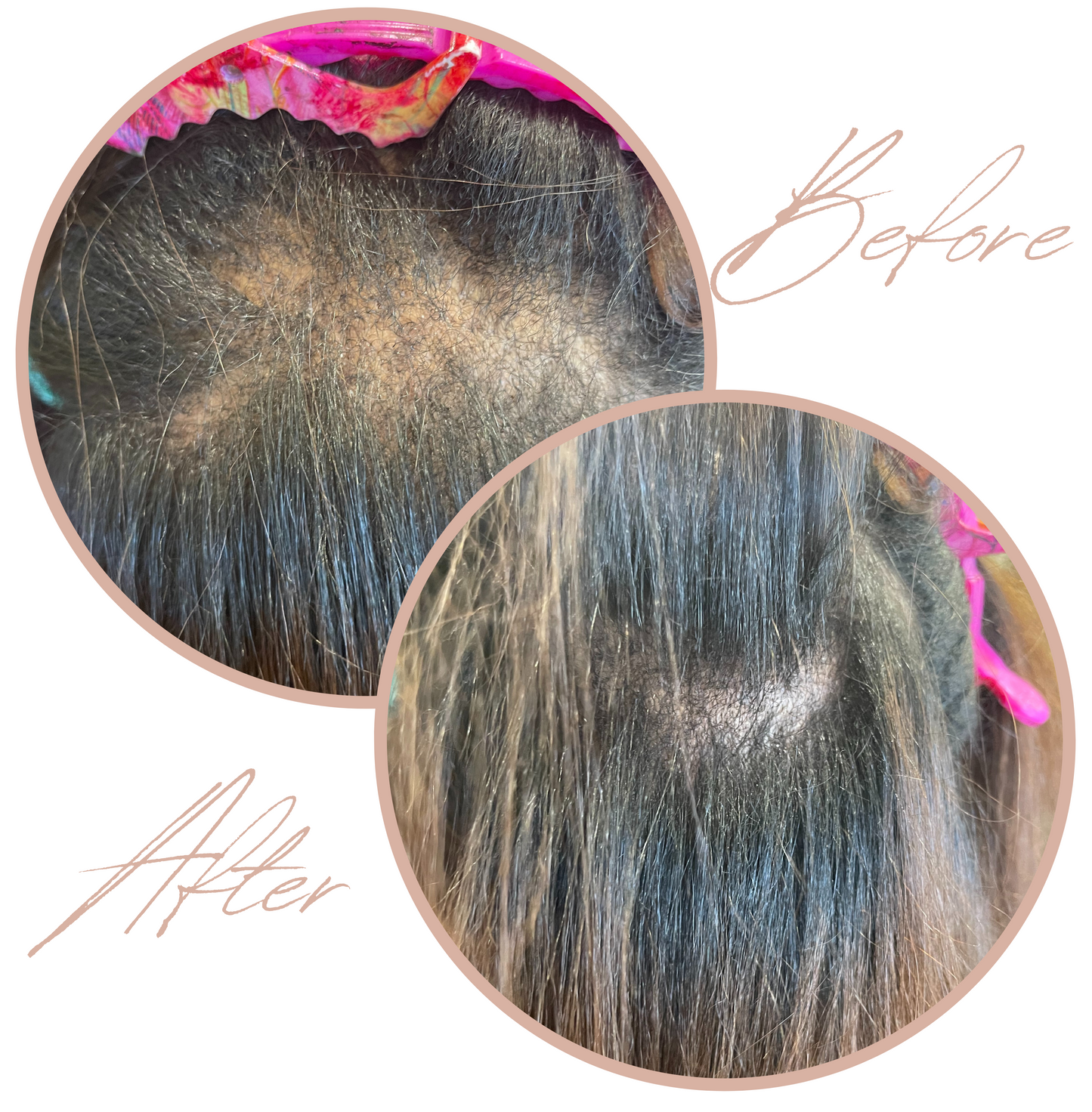 1 Hair Growth Serum